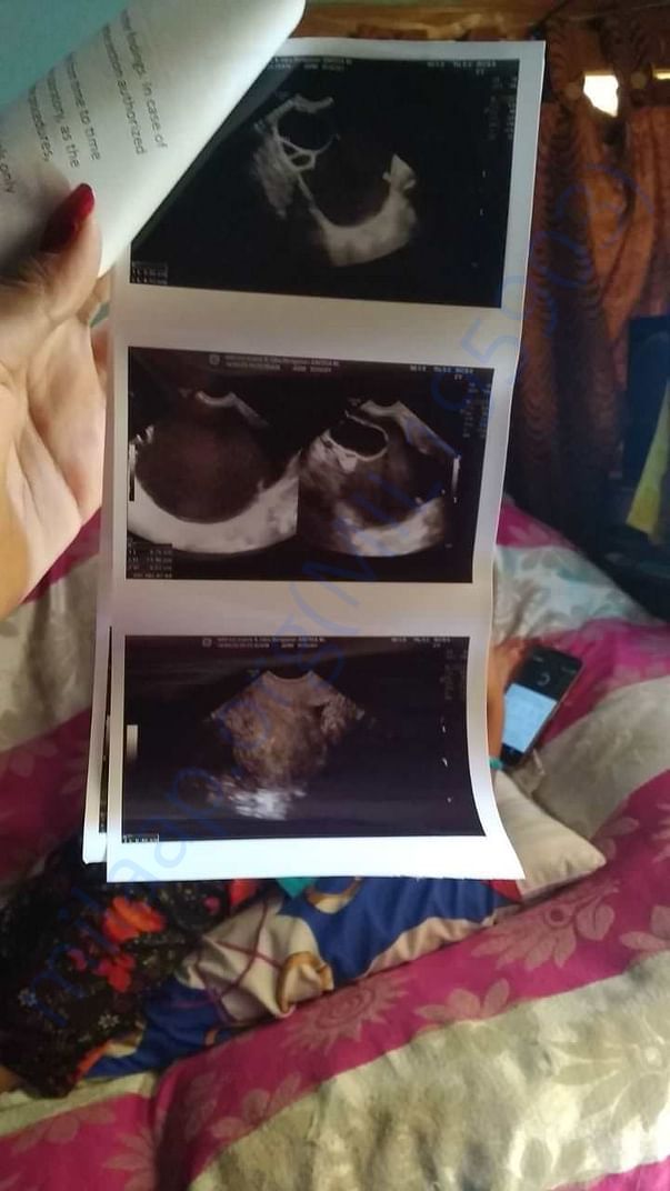 Scan copy