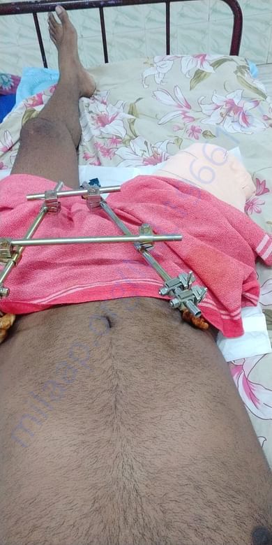 After surgery Photo
