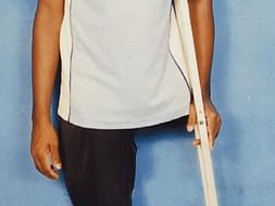 Help Myself To Get My Artificial Limbs