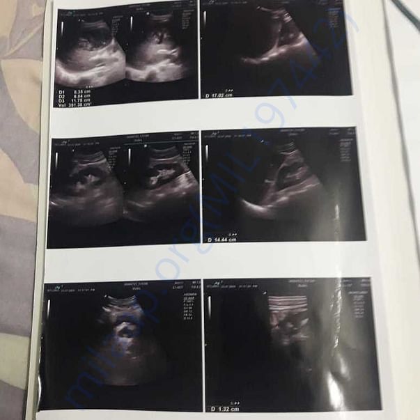 Medical Report