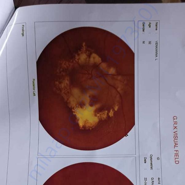 Medical Report