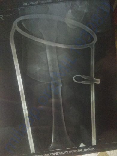 X ray