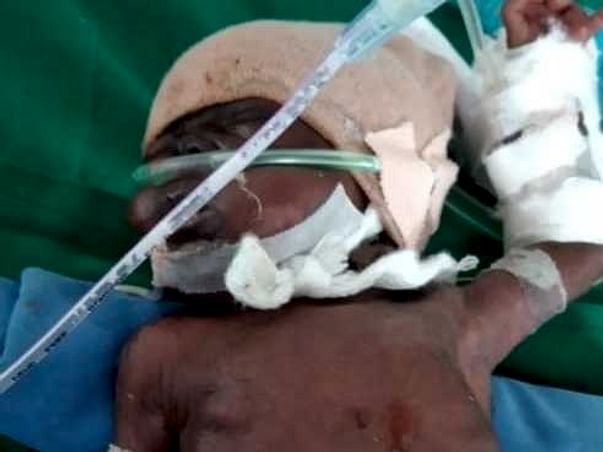 Support Baby Of Zeenath To Undergo Her Treatment And Medication