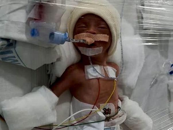 24 years old Ramesh needs your help fight Complications of Pre-mature Birth of Baby