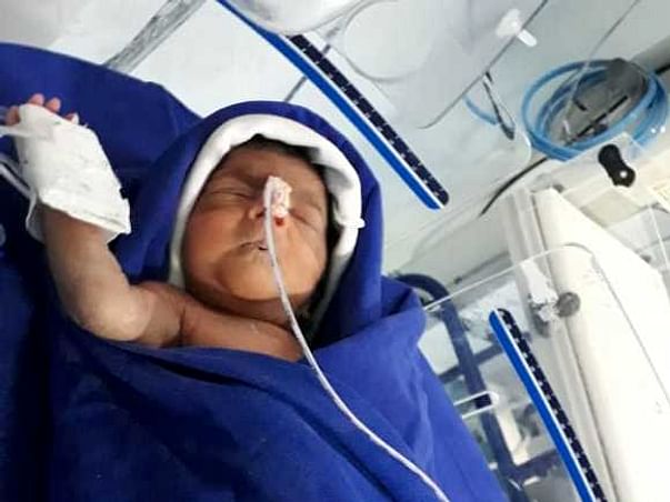 My 13 day old baby is admitted in the ICU and is struggling to breathe