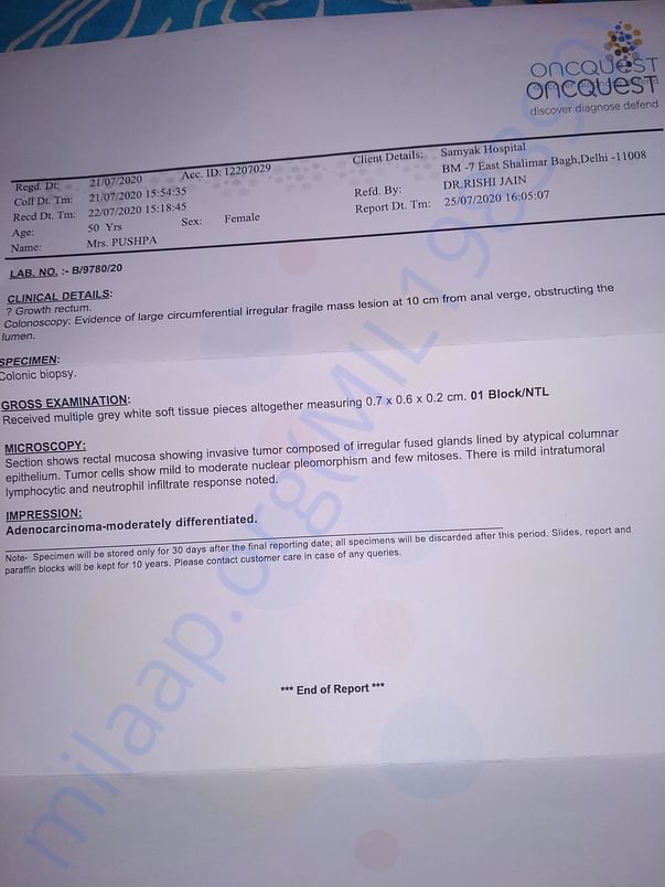 Doctor said surgery is needed to remove the tumor ,HELP US PLZ