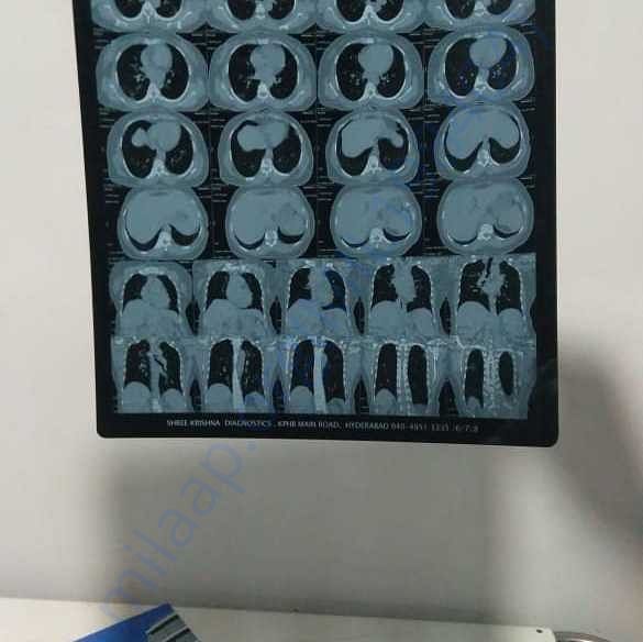 Medical Report
