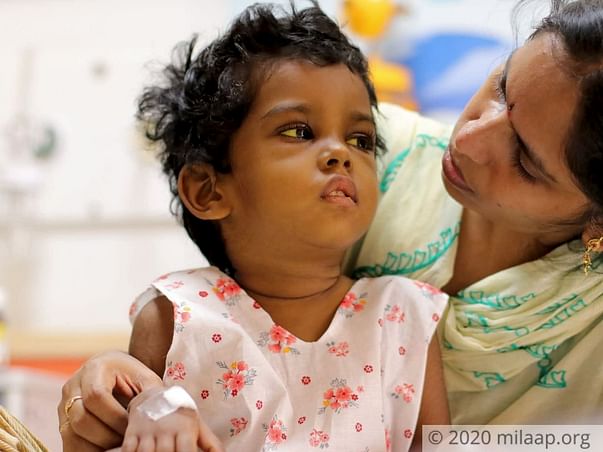 A Dangerous Liver Disease Has Taken Away This 4-Year-Old’s Smile