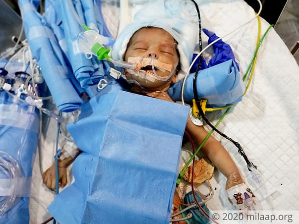 1-Month-Old Baby Girl's Father Needs Help To Save Her Life