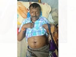 My Uncle Needs Your Urgent Support In Fighting Lungs Failure