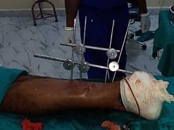 Support Sankar Recover From Accident