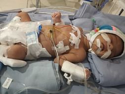 This 15 Days Old Needs Your Urgent Support In Fighting Respiratory Distress Syndrome And Birth Asphyxia