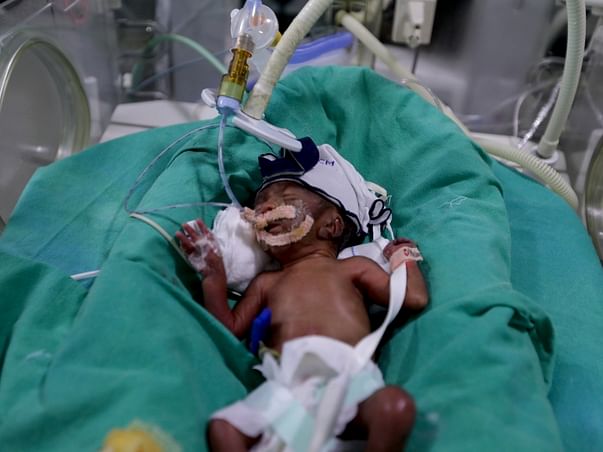 Help This Baby Get A Second Chance At Life"Kailash Nath"