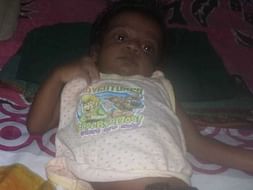 This 5 Months Old Needs Your Urgent Support In Fighting An Atrial Septal Defect (ASD) (Hole In Heart)