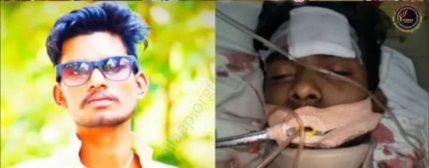 His picture before the surgery and while admitted to hospital