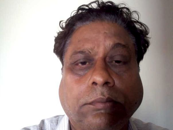 Help Hari Singh In Times Of Distress !!!