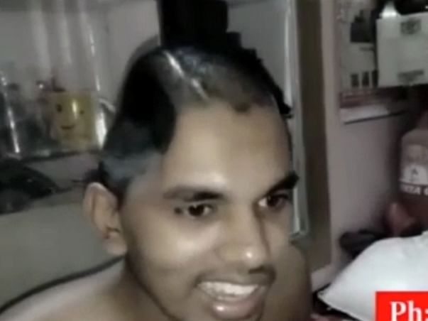 help Shravan Kumar recover from brain injury
