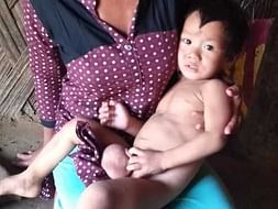 Bihan Needs Your Help For Immediate Surgery For Hydrocele Disease