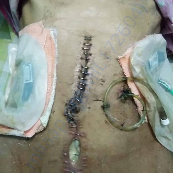 Pls help I got treatment in Yashoda Hospital somajiguda Hyderabad