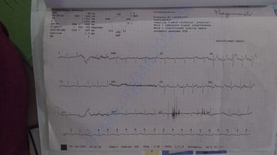 ECG Report