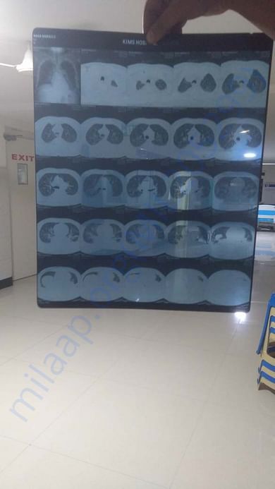 Lung Scan Report