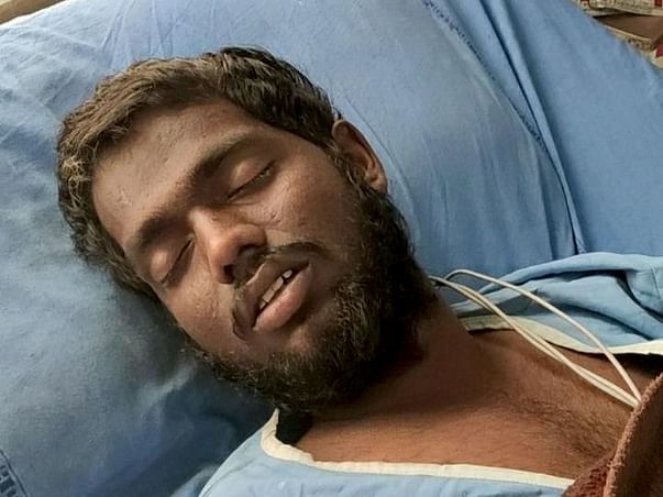 Support PRATHAP SINGH recover from Traumatic brain injury