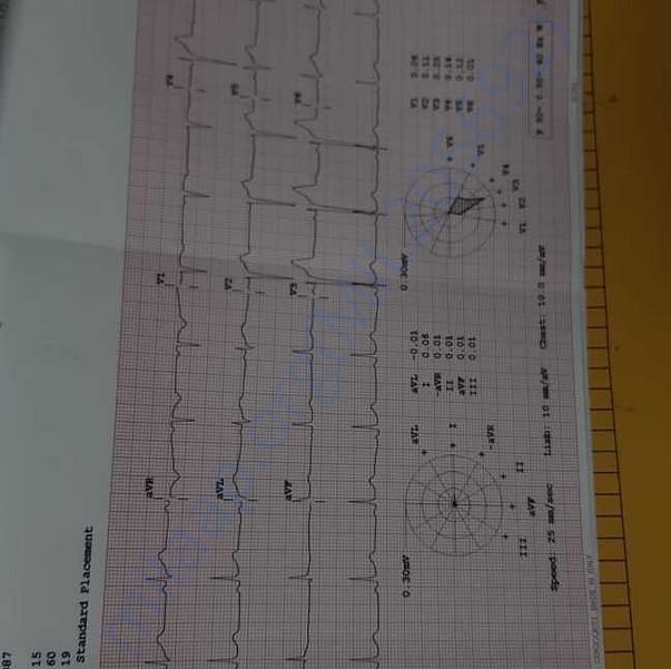 Medical Report