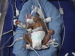 Support Premature Baby Fight Lungs and Blood Infection.