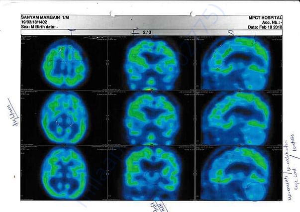 PET CT 1
