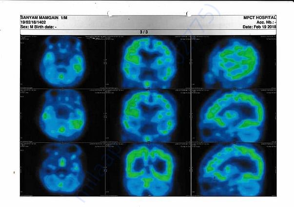 PET CT 2