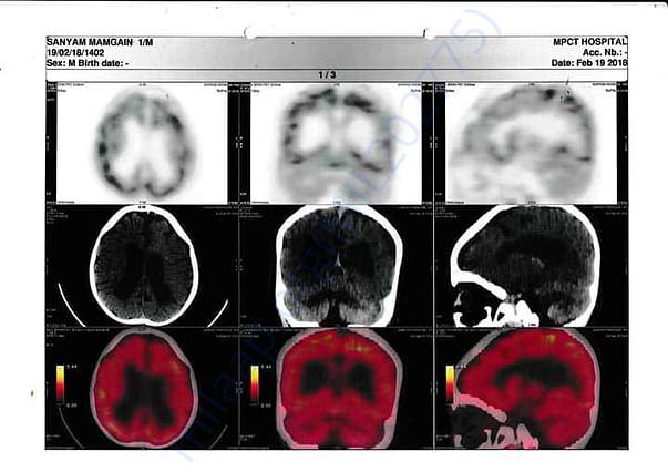 PET CT 3
