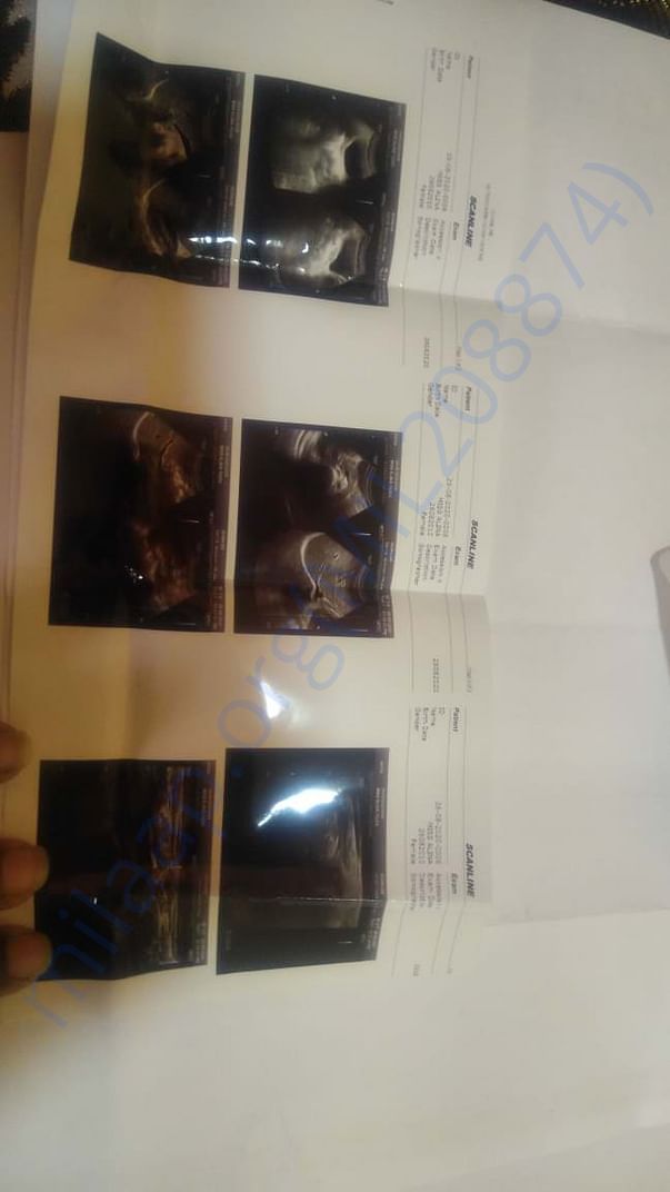 Scan report