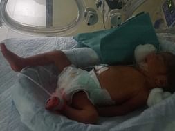 Twin Babies Needs Your Help To Recover!