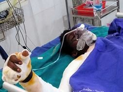 Help My Brother Recover From Road Accident