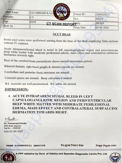 CT scan Report
