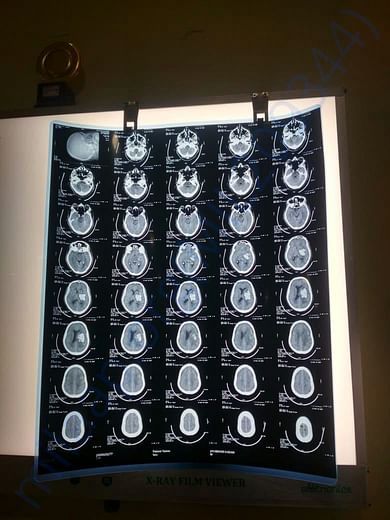 CT scan Image