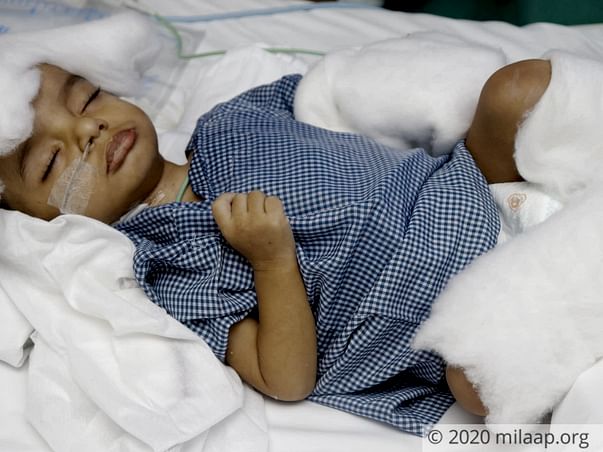 This 9-Month-Old Has Had 5 Brain Surgeries, Needs Your Help To Go Home