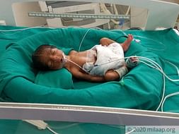 8 days old baby of foranti needs your help fight pre-maturity