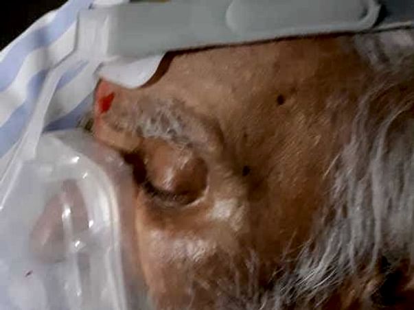 Support My Grandfather Srinivas Murthy Recover From Lungs Infection