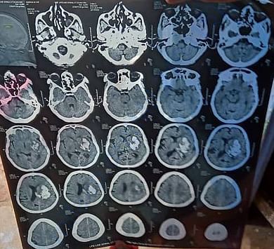 X ray report