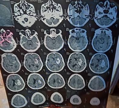 X ray report