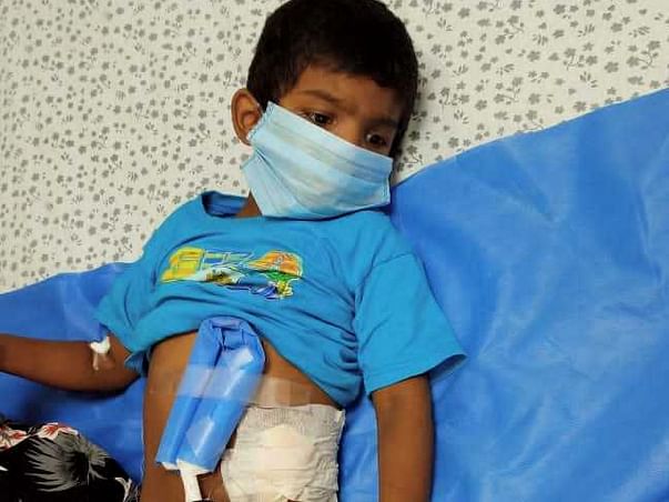 Am Naresh N My son Struggling with Chronic Kidney disease(CKD)