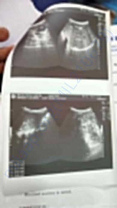 SCAN