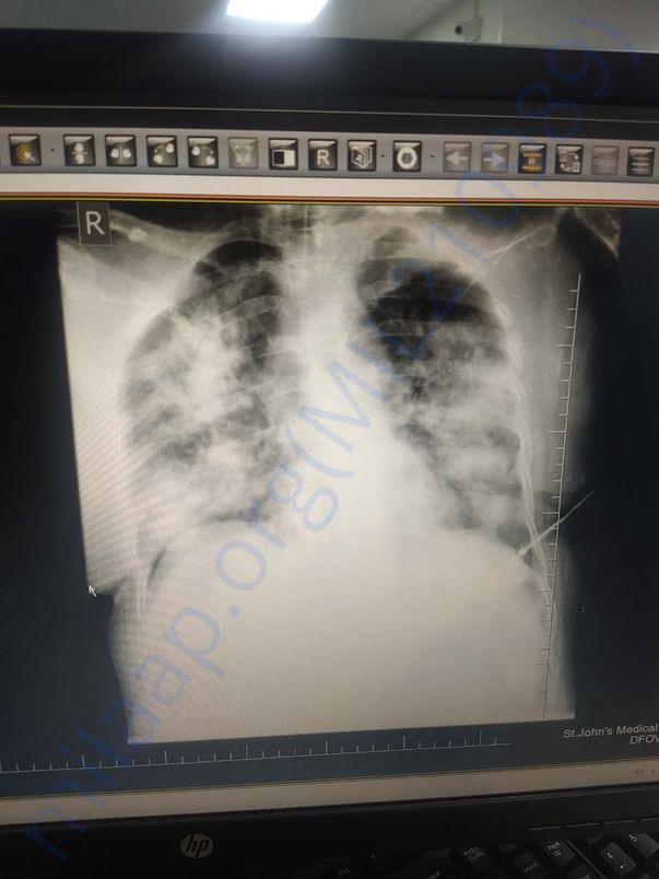 medical report