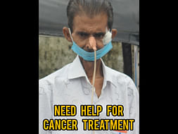 51 Years Old Rajendra Saini Needs Your Help Fight Oral Cancer