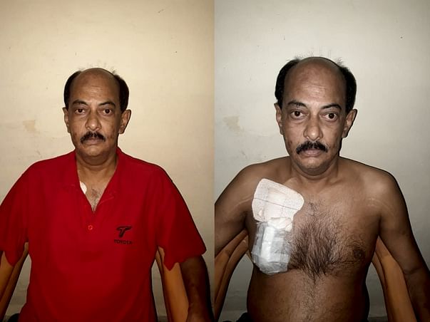 Support Mr. Peter To Recover From Kidney Problem