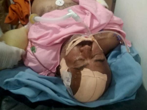 Help my father recover from Brain Hemorrhage