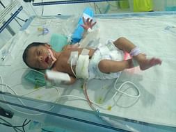 This 20 Days Old Needs Your Urgent Support To Undergo NICU Care