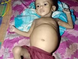 1 Year Old Saniah Needs Your Recover Stomach Tumour