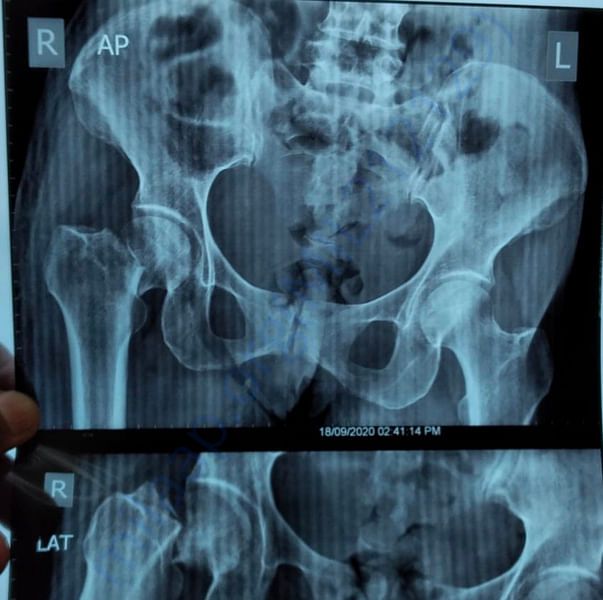 X Ray